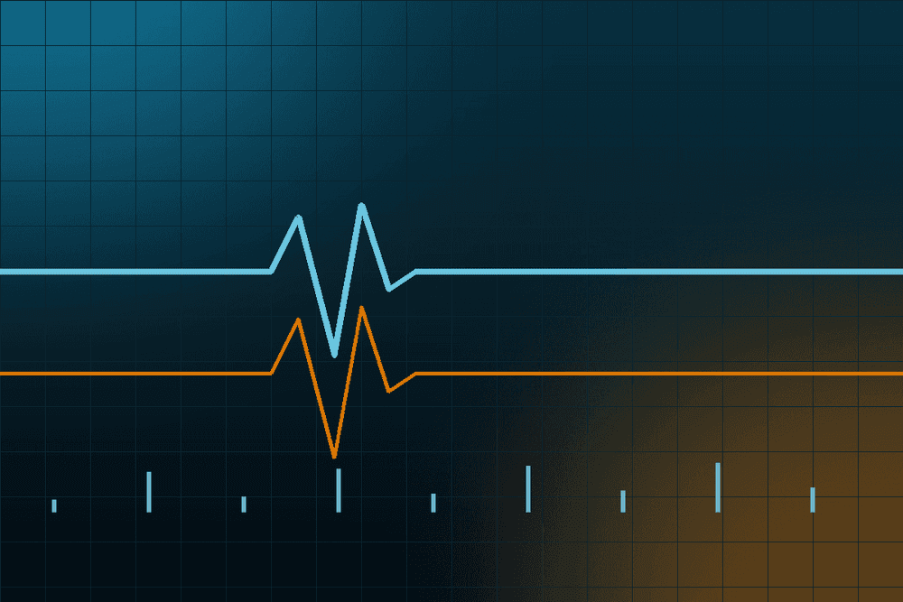An image uploaded to Strapi called veluma-monitoring