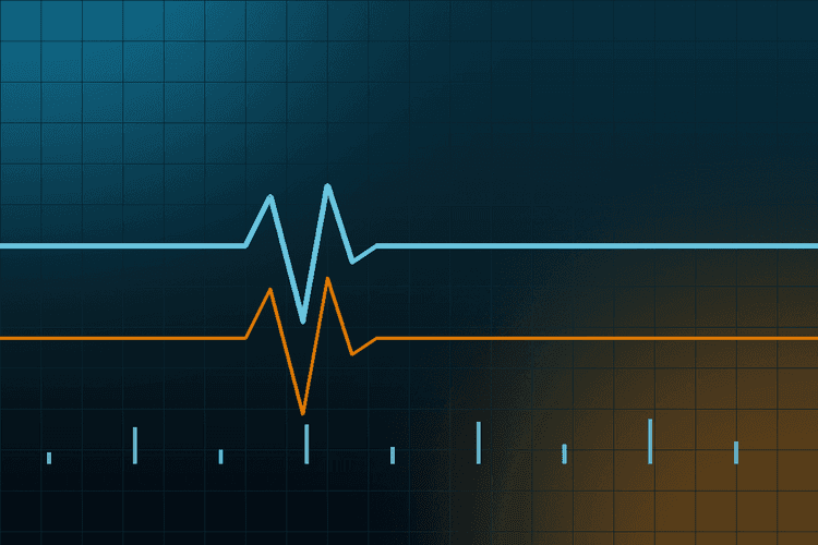 An image uploaded to Strapi called veluma-monitoring