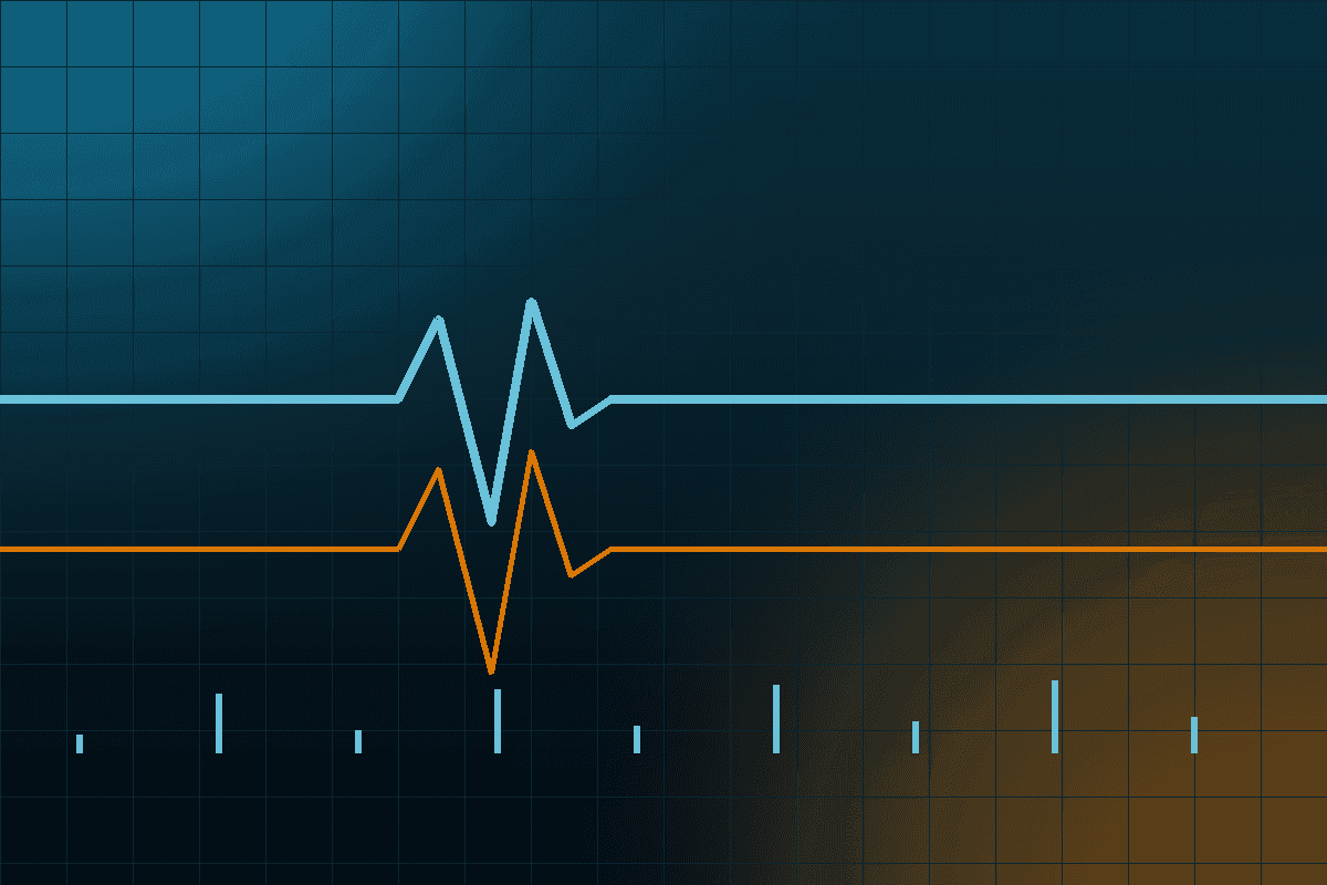 An image uploaded to Strapi called veluma-monitoring